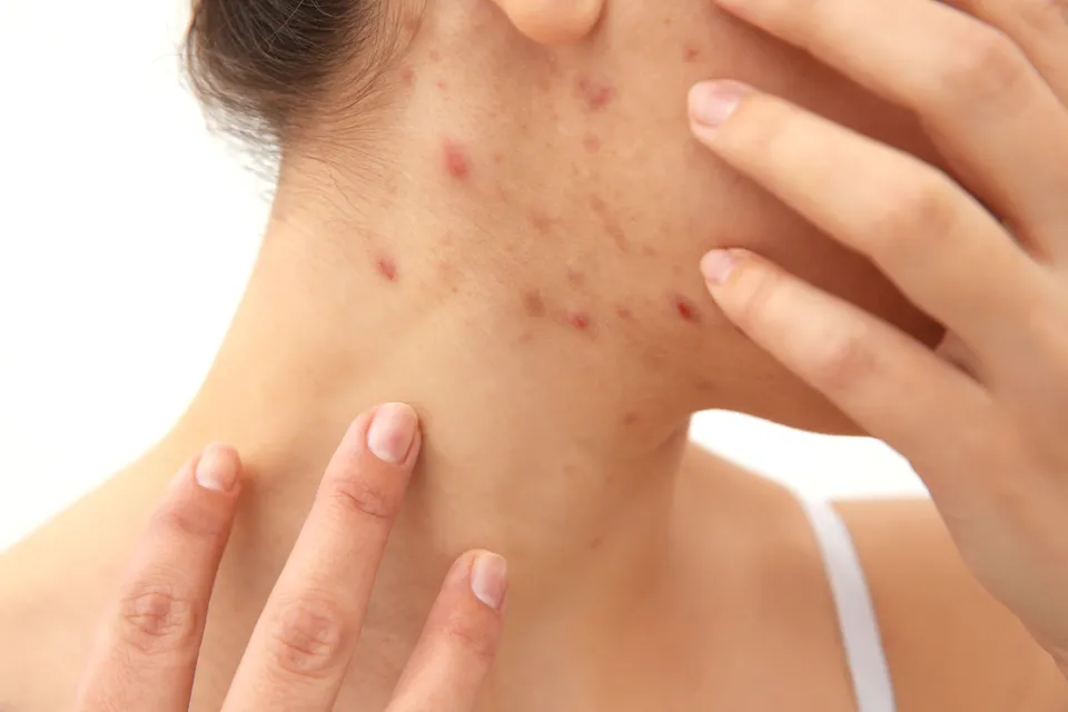 Dermatología