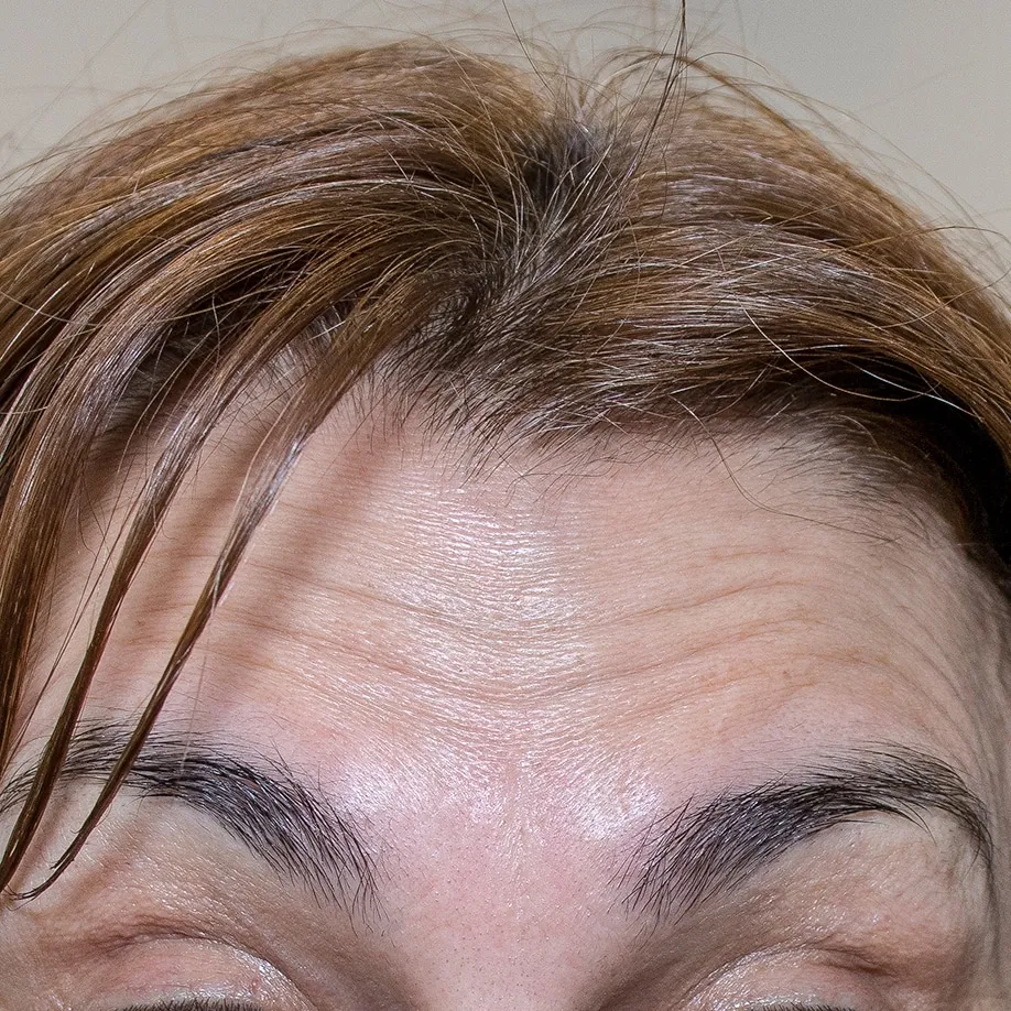 ANTES