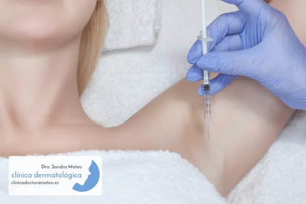 tratamiento-hiperhidrosis-axilar